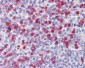 MMP9 / Gelatinase B Antibody (Internal)